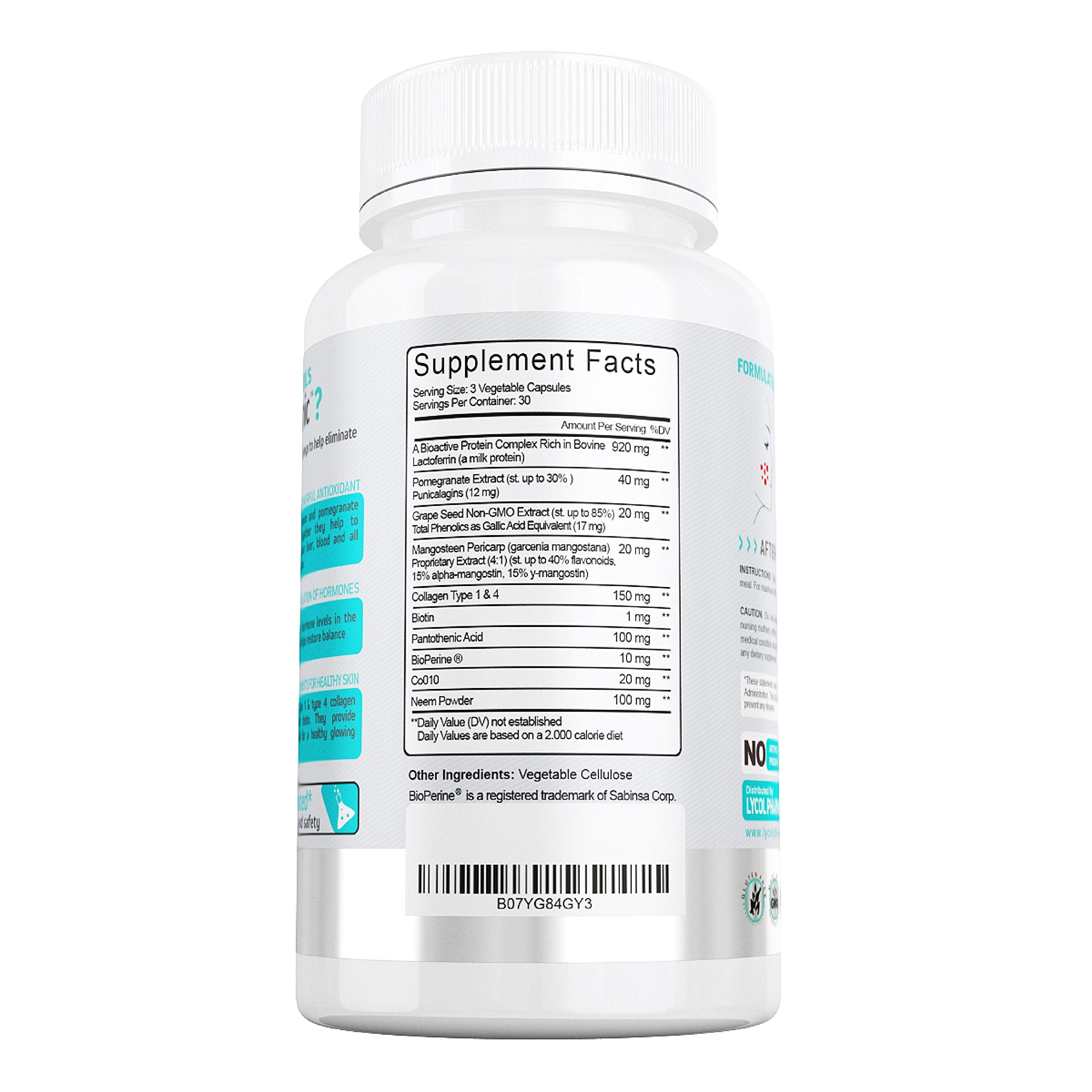 Acne Treatment Vitamin Supplements for Men, Women & Teens 90 Vegan Capsules (6986771726519)